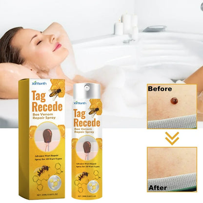 Eliminador de verrugas con veneno de abejas Tag Recede™