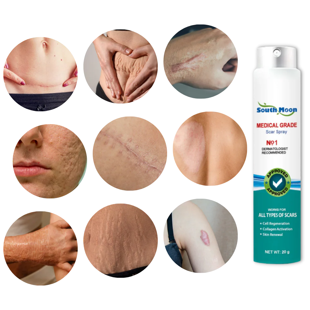 Spray para cicatrices South Moon™ Medical Grade