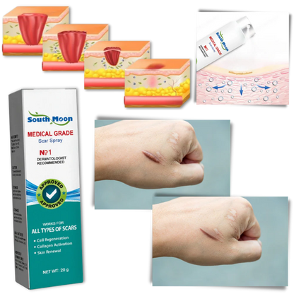 Spray para cicatrices South Moon™ Medical Grade